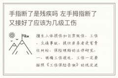 手指断了是残疾吗 左手拇指断了又接好了应该为几级工伤